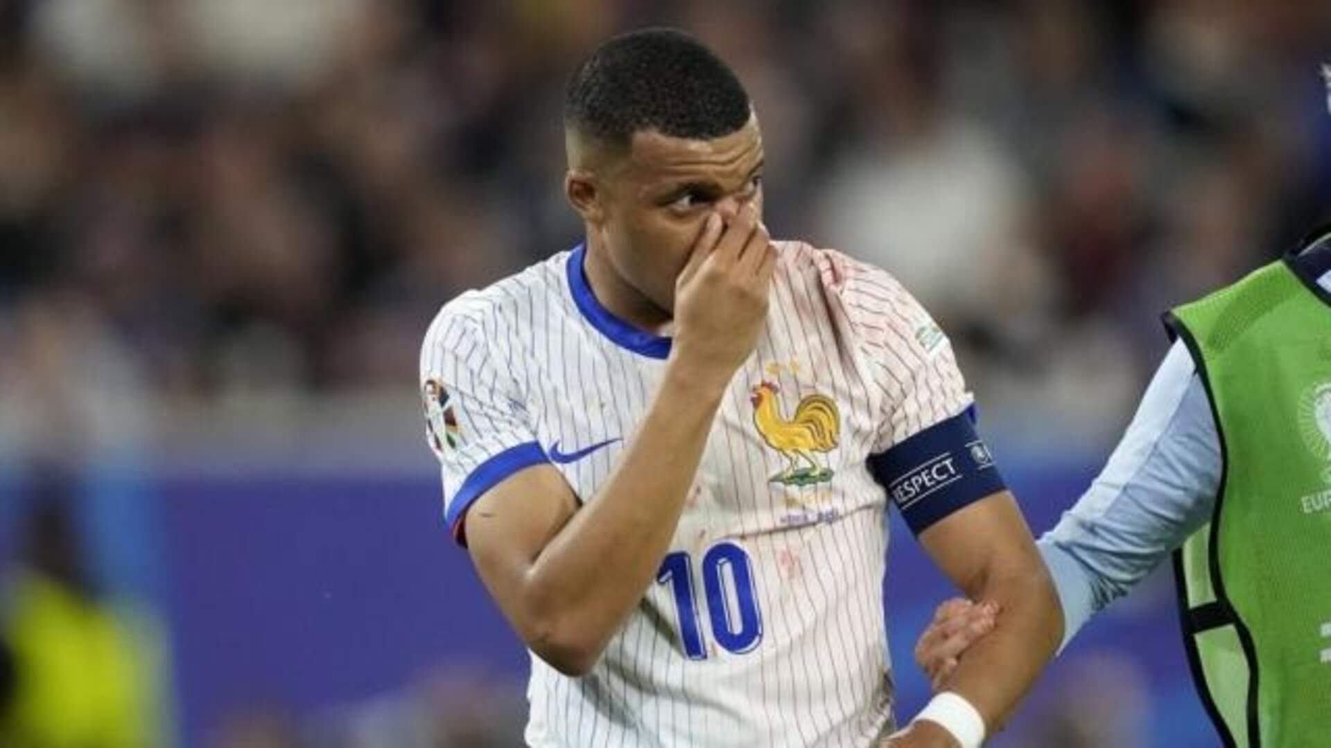 Euro 2024: Bagaimana Kondisi Kylian Mbappe Usai Cedera Patah Tulang Hidung?