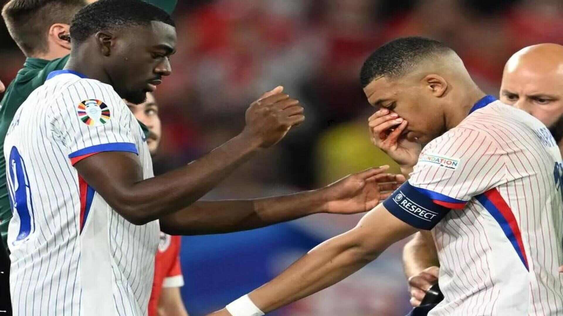 Cedera Patah Hidung, Performa Kylian Mbappe Diyakini Takkan Menurun di Euro 2024