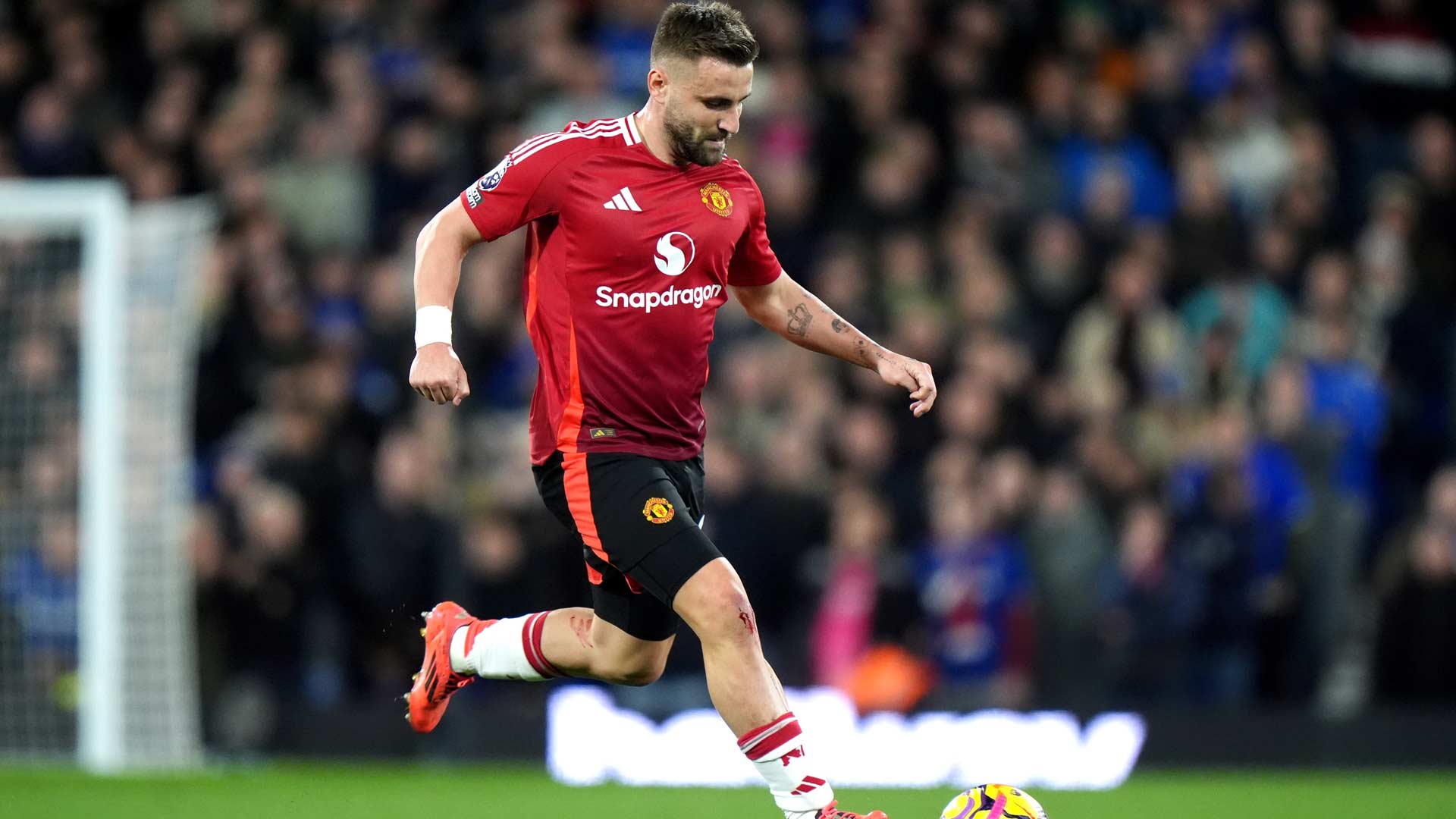 Cedera Baru Luke Shaw Jadi Pukulan Berat bagi Manchester United